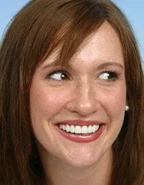 Our patient Erin smiling