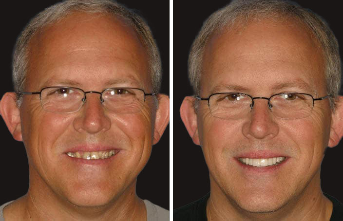 Collage of before and after cosmetic dental treatment photo