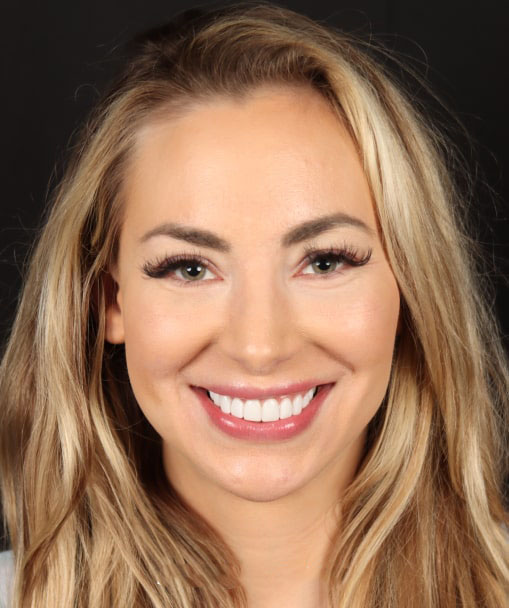 Close up photo of our client while smiling