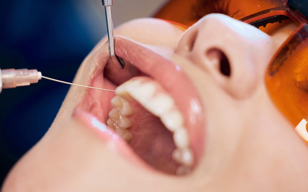 Early Signs of Gum Disease You Shouldn’t Ignore