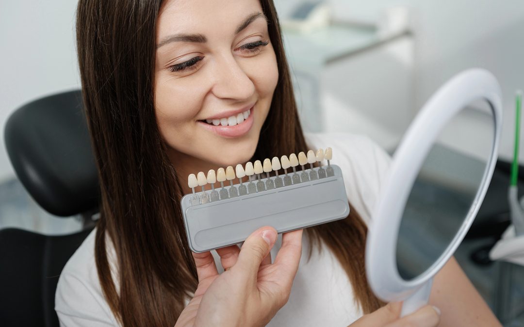 What Are Porcelain Veneers Made Of and Why Material Matters